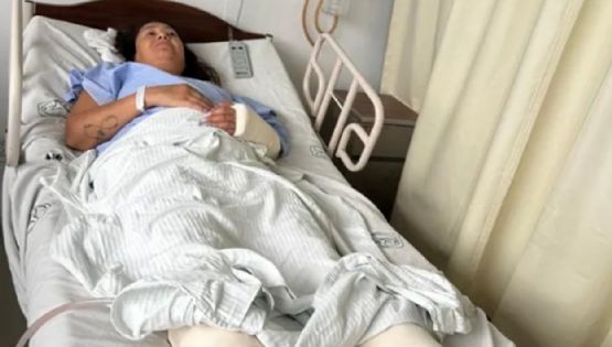 Buscan repatriar a una argentina que cayó de un tercer piso en México 