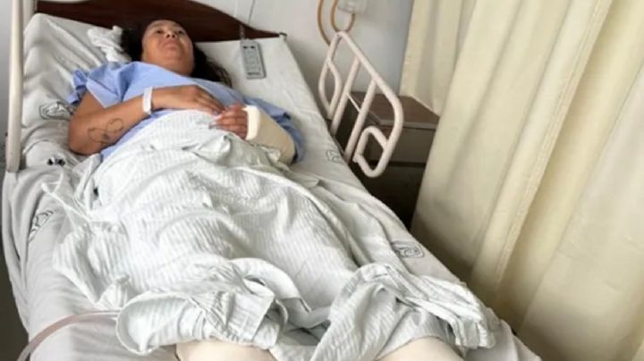 Buscan repatriar a una argentina que cayó de un tercer piso en México 