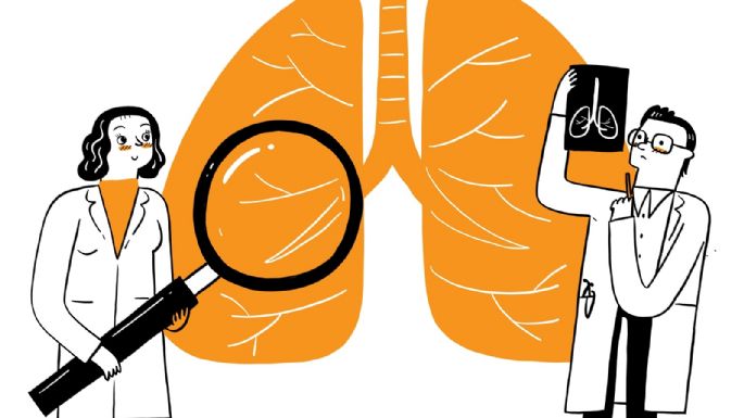 En lo que va del año se notificaron más de 13.000 casos de tuberculosis en Argentina