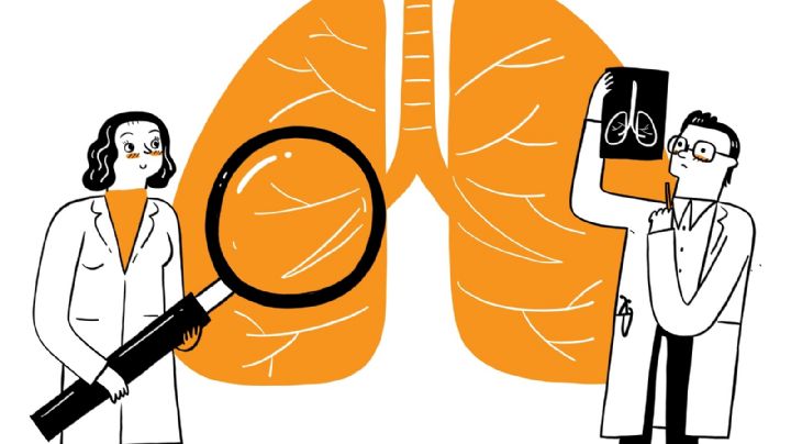 En lo que va del año se notificaron más de 13.000 casos de tuberculosis en Argentina