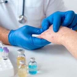 Alerta epidemiológica: cuántos casos de sarampión hay en Argentina