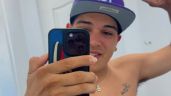 Foto ilustrativa de la nota titulada: Thiago Medina mostró las cicatrices de su accidente