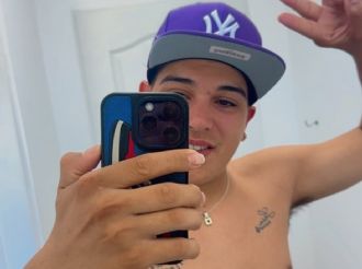 Thiago Medina mostró las cicatrices de su accidente