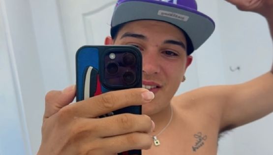 Thiago Medina mostró las cicatrices de su accidente