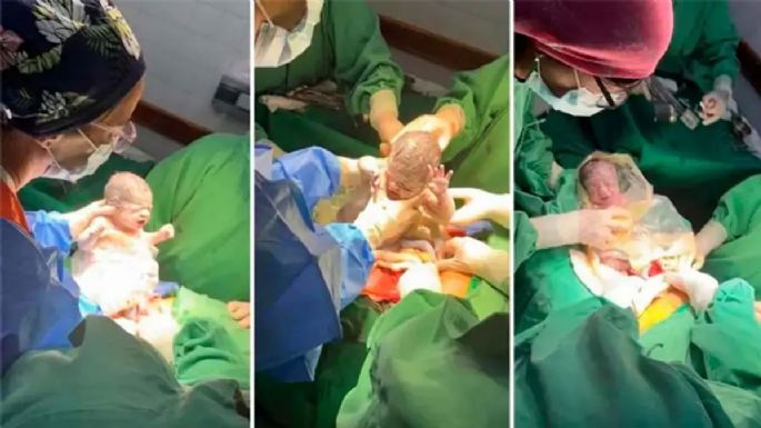 Nacieron trigemelas, un caso que se da en 100 millones de nacimientos