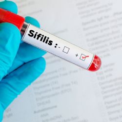 Aumentan los casos de sífilis en el mundo: qué pasa en Mendoza