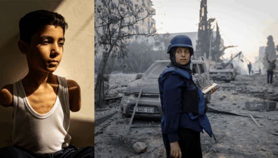 La conmovedora imagen de un niño mutilado en Gaza ganó el premio a la Foto del Año