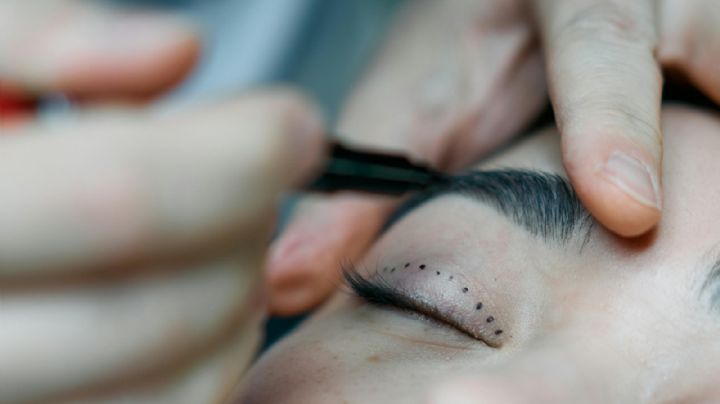 Creció el número de jóvenes que se someten a cirugías faciales