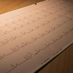 Nueva droga para el tratamiento del infarto de miocardio