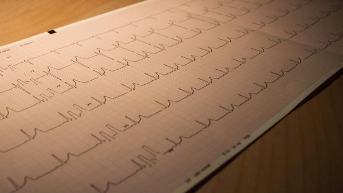Nueva droga para el tratamiento del infarto de miocardio