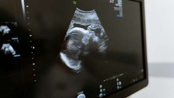 Cómo afecta la calidad de vida en la posibilidad de tener hijos