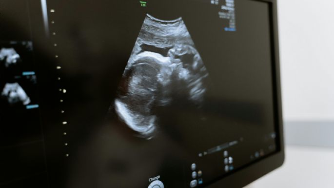 Cómo afecta la calidad de vida en la posibilidad de tener hijos