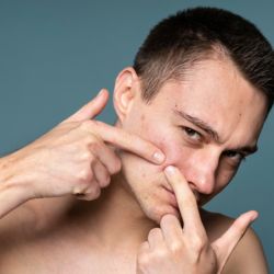 Levadura, un aliado natural contra el acné