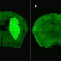 Científicos del CONICET logran neutralizar un tumor agresivo