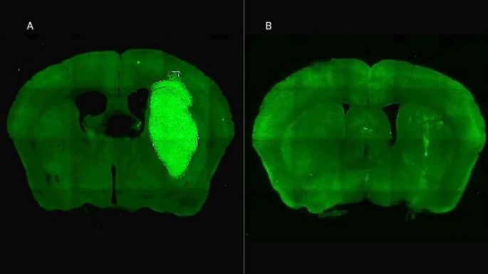 Científicos del CONICET logran neutralizar un tumor agresivo
