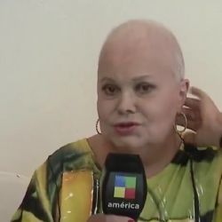 Marta González habló de su lucha contra el cáncer y se quitó la peluca en vivo