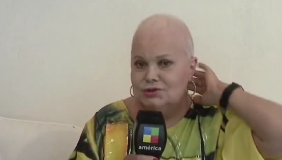 Marta González habló de su lucha contra el cáncer y se quitó la peluca en vivo