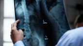 Foto ilustrativa de la nota titulada: Crean una terapia para regenerar huesos con células del cordón umbilical