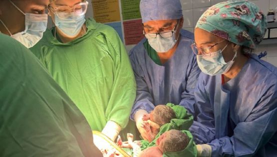 Nacieron trigemelas en Salta: un caso que sucede cada un millón 