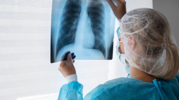 Las últimas novedades sobre avances en fibrosis quística 