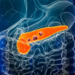 Científicos españoles lograron eliminar el cáncer de páncreas en ratones 