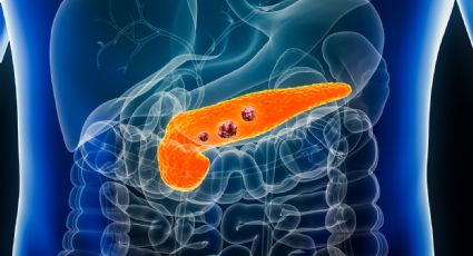 Científicos españoles lograron eliminar el cáncer de páncreas en ratones 