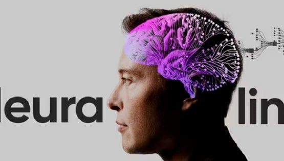 El chip de Neuralink que promete devolverle la visión a los ciegos