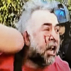 Video: así fue la agresión de la Policía Federal a un camarógrafo de A24