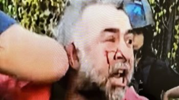 Video: así fue la agresión de la Policía Federal a un camarógrafo de A24