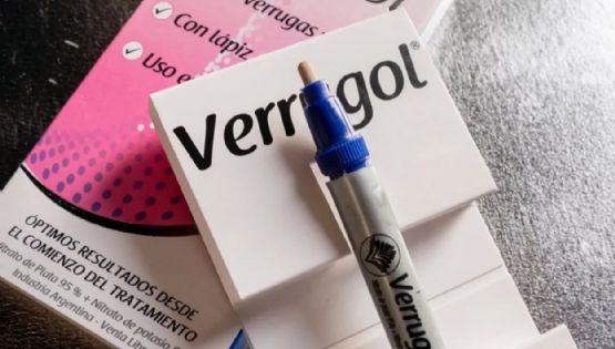La ANMAT ordenó retirar del mercado del producto Verrugol
