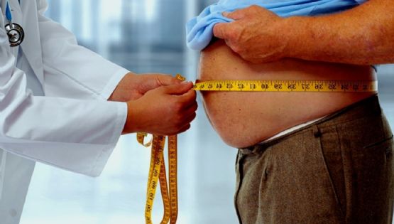 En Argentina, 6 de cada 10 adultos padece de obesidad 