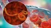 Foto ilustrativa de la nota titulada: Activan protocolos por ébola en Argentina por embarcaciones provenientes de zonas de riesgo 