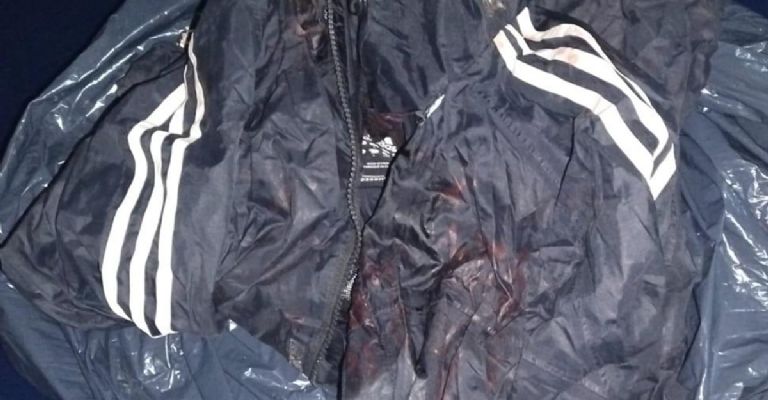 La campera del individuo que fue retenida para que se le realice el barrido electrónico