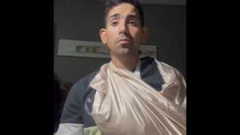 Un joven llegó fracturado al Hospital Central y le pidieron que vuelva el lunes